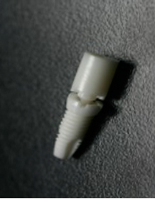 Das im CAM-ULTRASONIC hergestellte "A"-Implantat, Quelle: ots.at